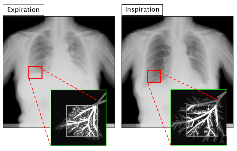 Visualization of biological functions; the basic principle of ventilatory function