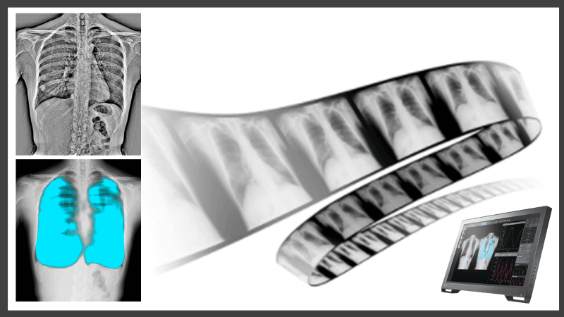 Dynamic digital radiography and image analysis technologies