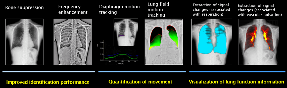 Group of images for digital dynamic radiography