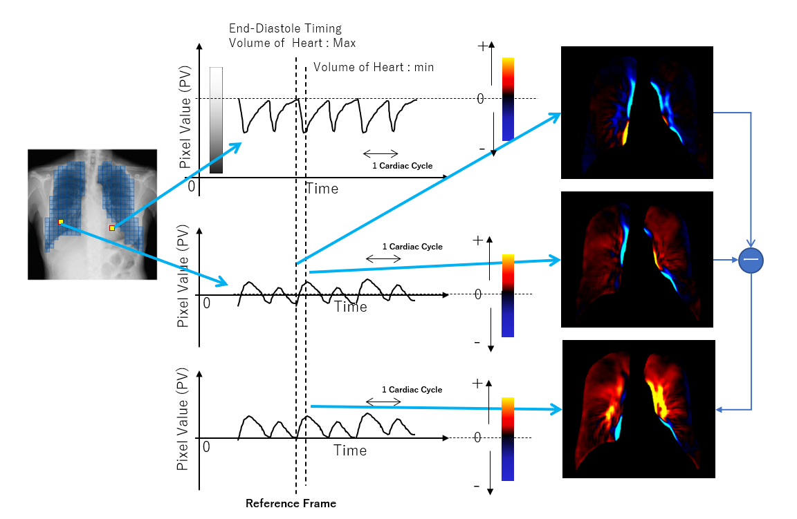 Visualization of biological functions; an example of a signal change (associated with vascular pulsation) analysis algorithm