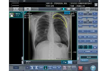 サムネイル：画像診断ワークステーション「CS-7」の新機能としてSTAT画像所見報告支援機能「STAT Link」の提供を開始